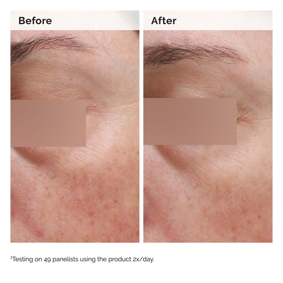 niacinamide-5-face-and-body-emulsion-l6 2024-08-23-ORD-Nia-5pct-Face-Body-B-A-Elasticity-Global-02-1x1.jpg