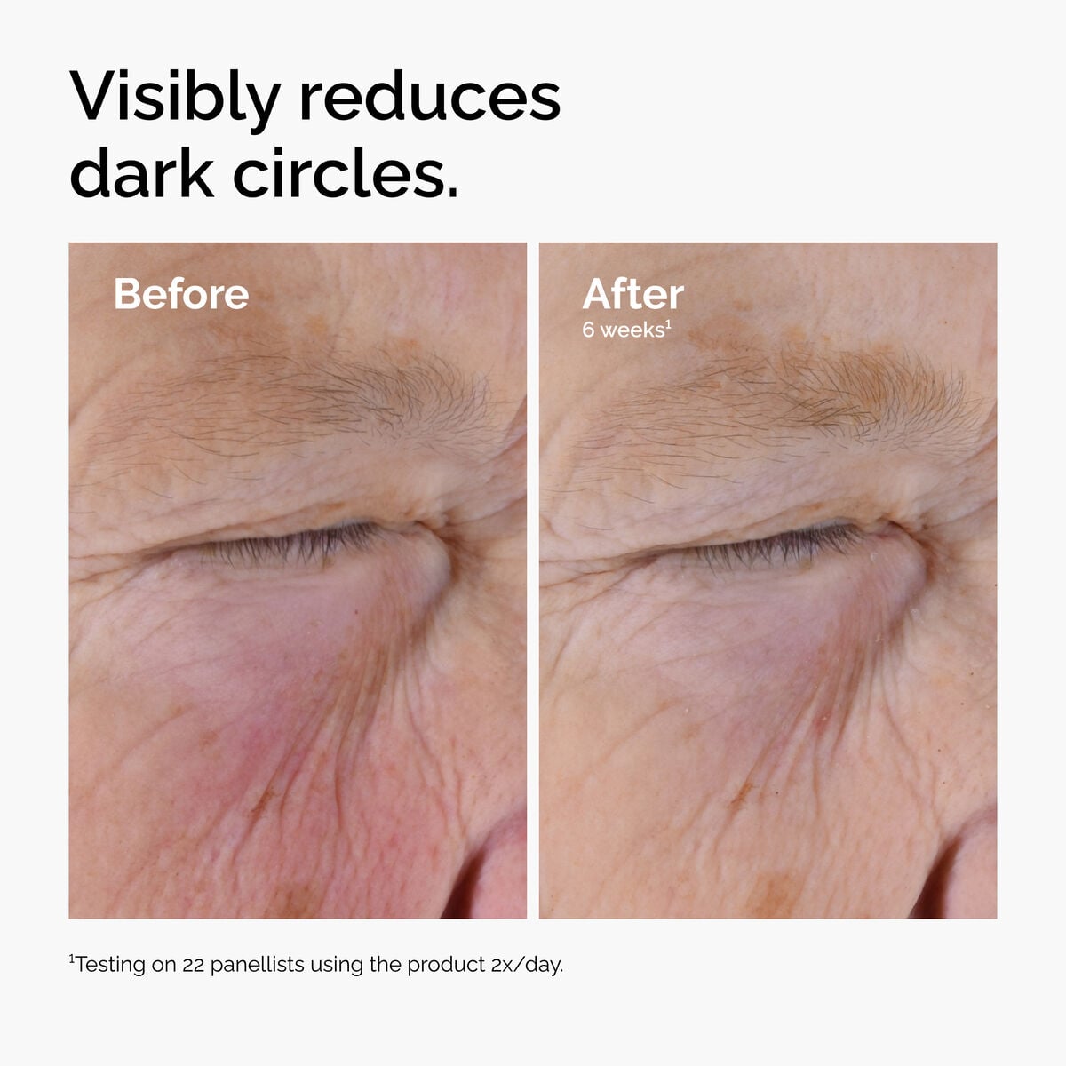 caffeine-solution-5-egcg-eye-serum-m1 ord-caffeine-solution-egcg-dark-circles-before-after.jpg