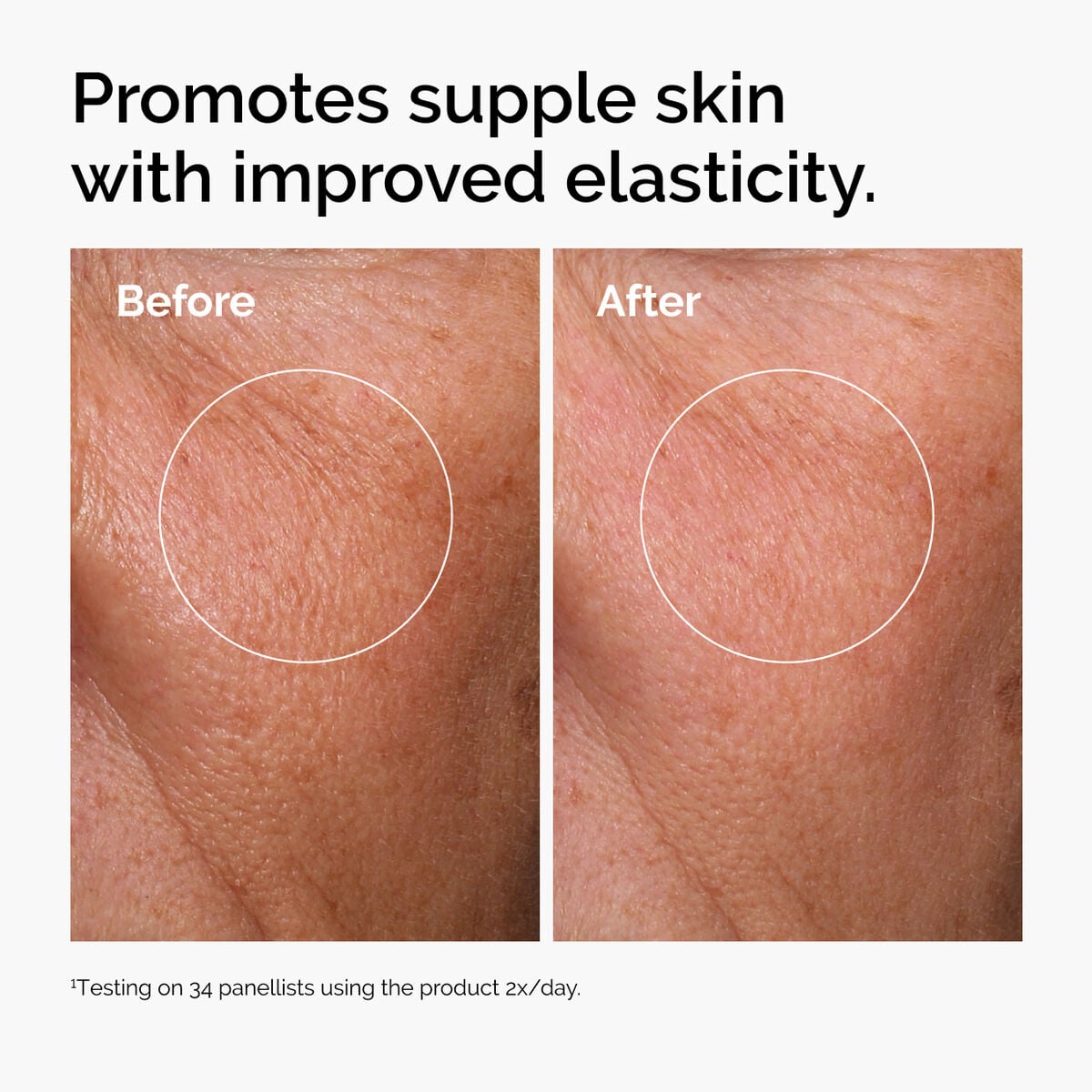 hyaluronic-acid-2-b5-with-ceramides-n7 ord-hyaluronic-acid-2pct-b5-hydrating-serum-before-after-elasticity.jpg